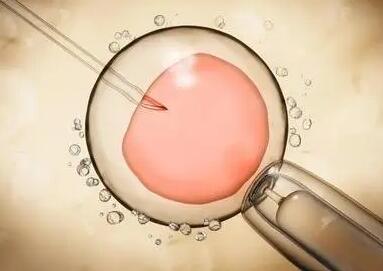 卵巢早衰做试管能保证胎儿正常发育专业技术可以提高成功率
