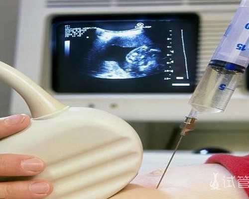 国内供卵排队多长时间,第三代试管婴儿准确率,第三代试管婴儿筛查的准确率有多高