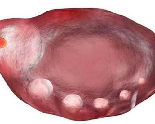 国内正规试管代怀机构,怎样可以选择到适合自己且效果好的促排卵方案？