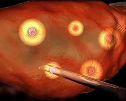 国内做供卵的机构有哪些,一般做一次试管需要多长时间(求具体的天数是多少)