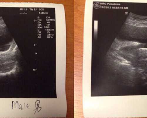 国内供卵的机构有哪些医院,2026湖州试管婴儿医院排名公布最新试管婴医院选择攻略