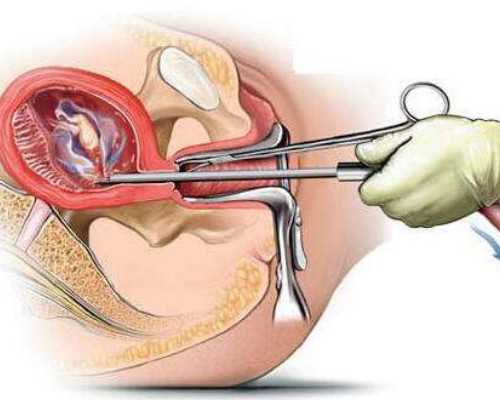国内供卵一般多少钱,三代试管婴儿哪些人群适用(第三代试管婴儿健康有保证吗)