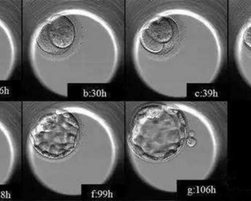 国内助孕供卵网点,去柬埔寨试管生男孩有什么条件，赴柬埔寨做试管生男孩的三大条件及注意事项